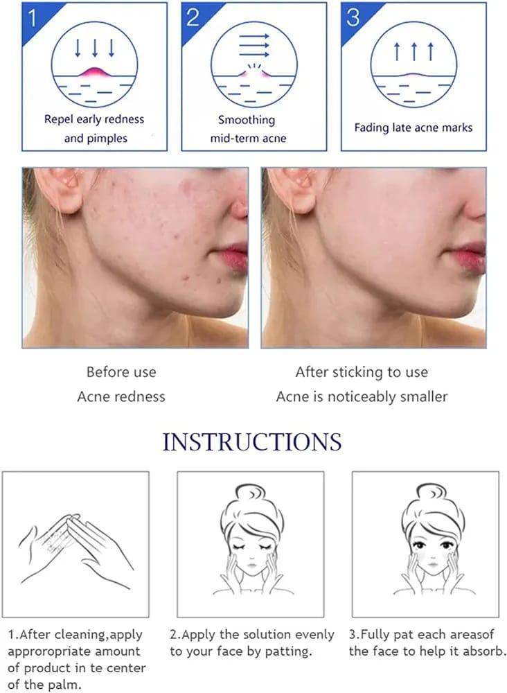Anti Acne Whitening Facial Serum