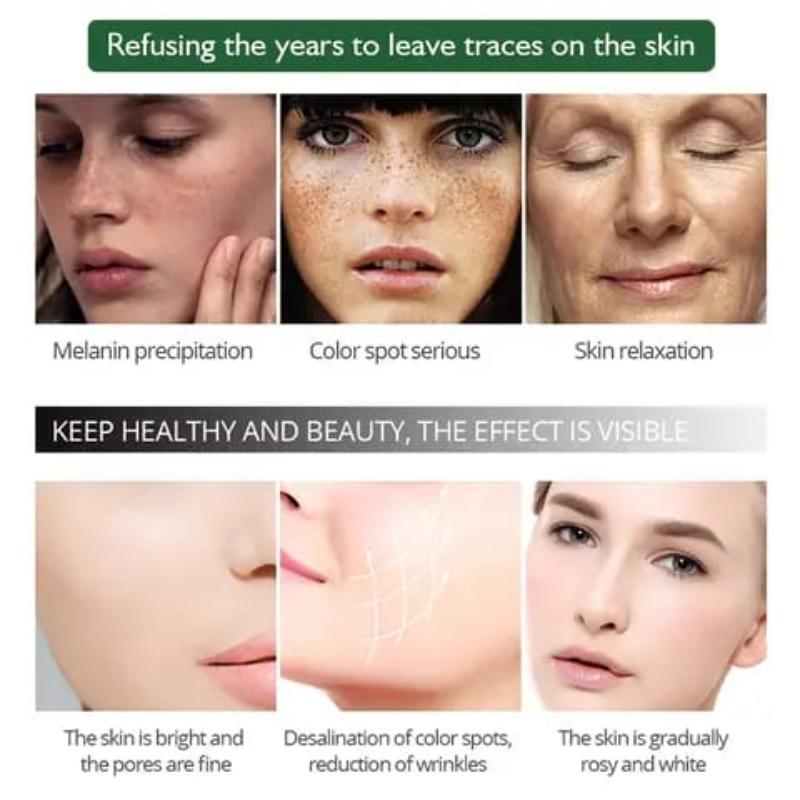 Beauty Anti Freckle Serum - 30 ml